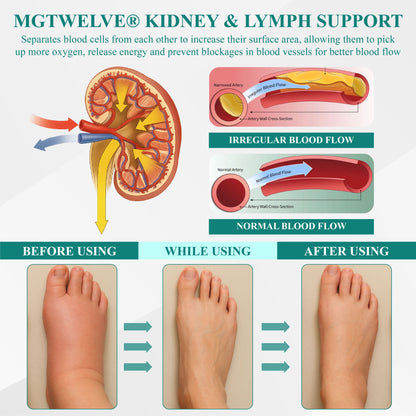 MgTwelve® Kidney & Lymph Support